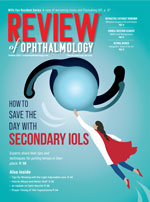 Review of Ophthalmology