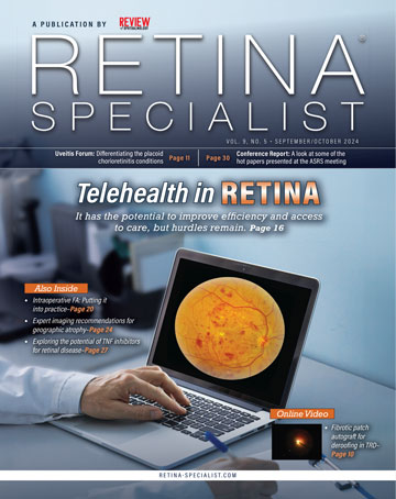 Retina Specialist